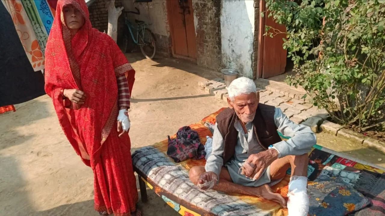 Four People Including Father-in-law And Daughter-in-law Were Bitten By A Dog After Entering The House In Sitapur, Condition Of One Is Critical.